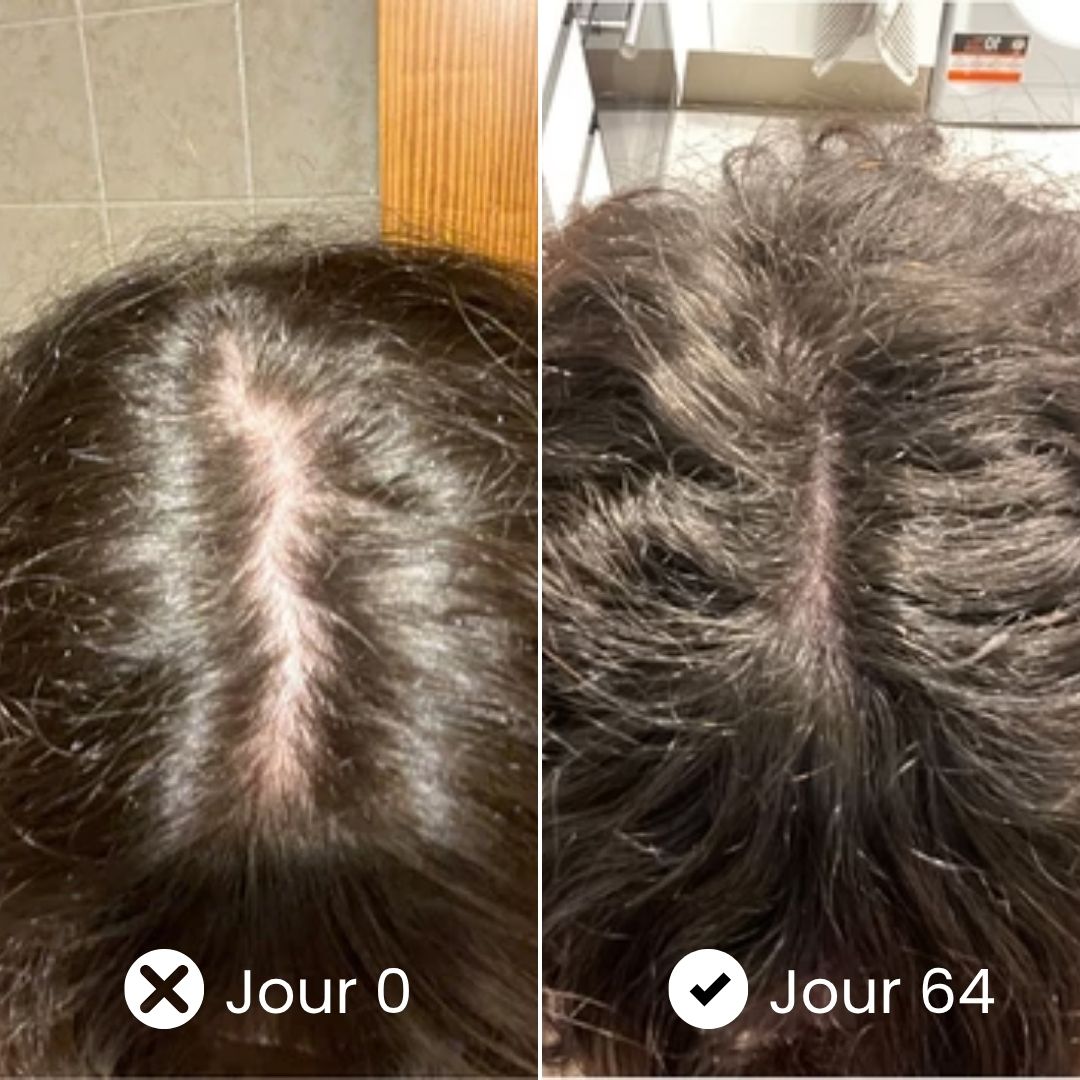 Strong Hair - Pousse et cheveux plus forts