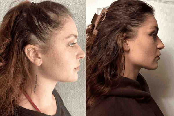 Avant / Après de Émilie P