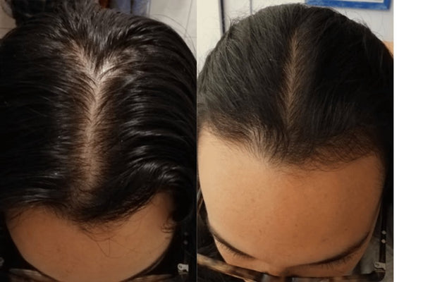 Avant / Après de Camille D