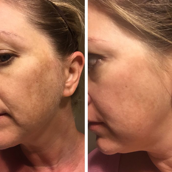 Avant / Après de Sandrine C.