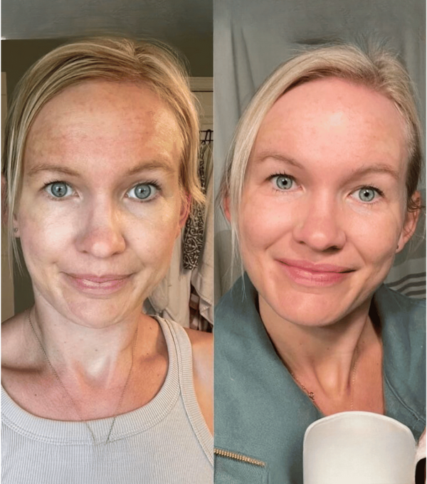 Avant / Après de Agnès.W